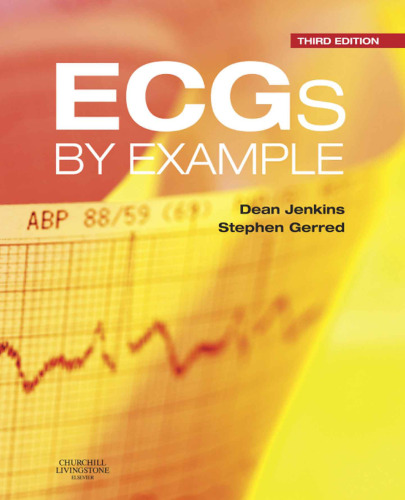 ECGs by example