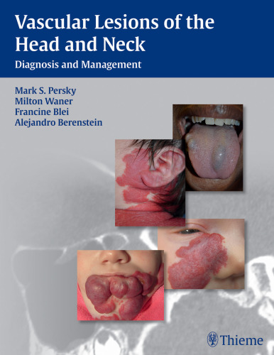 Vascular Lesions of the Head and Neck: Diagnosis and Management