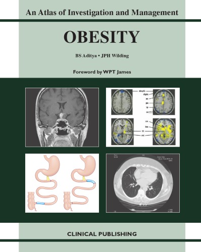 Obesity - An Atlas of Investigation and Management