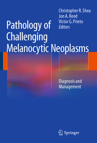 Pathology of Challenging Melanocytic Neoplasms: Diagnosis and Management