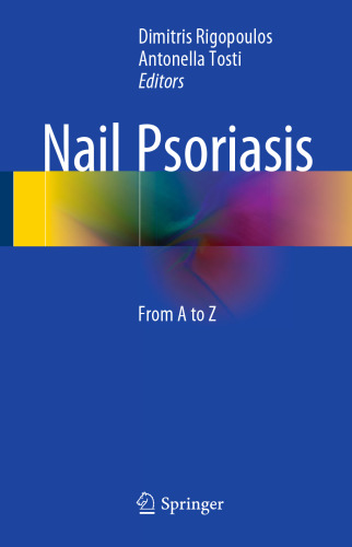 Nail Psoriasis: From A to Z