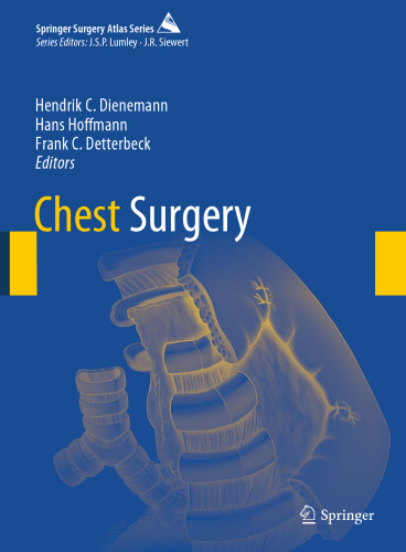 Chest Surgery