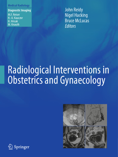 Radiological Interventions in Obstetrics and Gynaecology