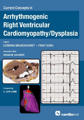 Current Concepts in Arrhythmogenic Right Ventricular Cardiomyopathy / Dysplasia