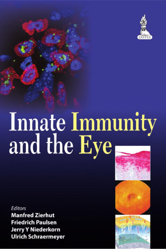 Innate Immunity and the Eye