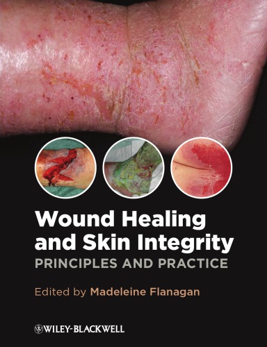 Wound Healing and Skin Integrity