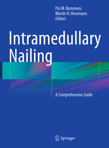 Intramedullary Nailing: A Comprehensive Guide