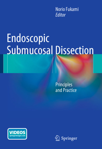 Endoscopic Submucosal Dissection: Principles and Practice