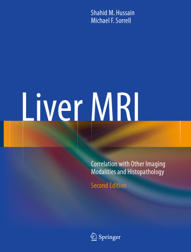 Liver MRI