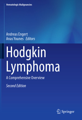 Hodgkin Lymphoma: A Comprehensive Overview