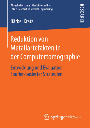 Reduktion von Metallartefakten in der Computertomographie: Entwicklung und Evaluation Fourier-basierter Strategien