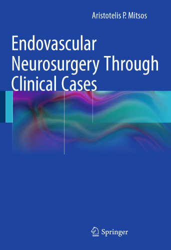 Endovascular Neurosurgery Through Clinical Cases