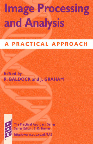 Image Processing and Analysis: A Practical Approach