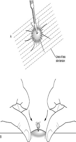 Atlas of Primary Care Procedures