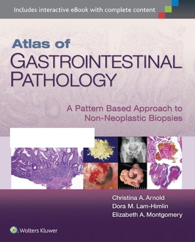 Atlas of Gastrointestinal Pathology: A Pattern Based Approach to Non-Neoplastic Biopsies