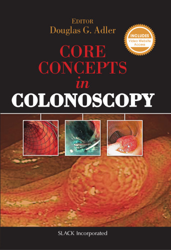 Core Concepts in Colonoscopy