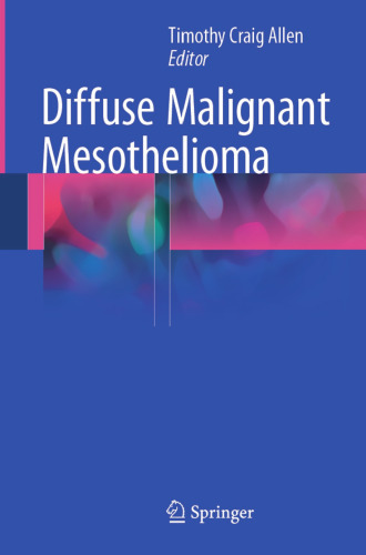 Diffuse Malignant Mesothelioma