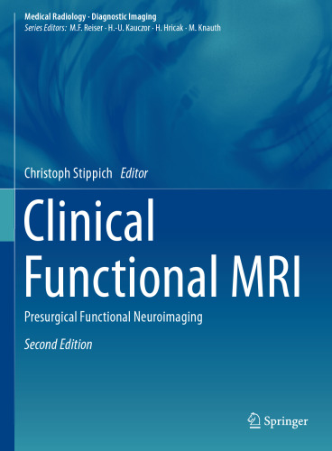 Clinical Functional MRI: Presurgical Functional Neuroimaging