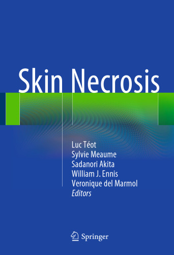 Skin Necrosis