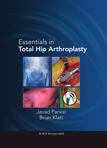 Essentials in Total Hip Arthroplasty