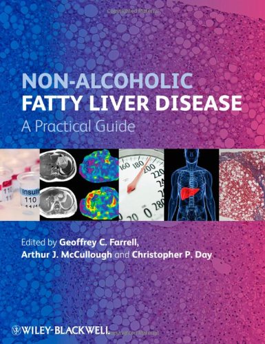 Non-Alcoholic Fatty Liver Disease: A Practical Guide