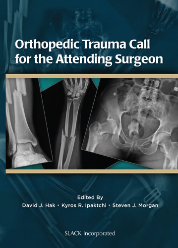 Orthopedic Trauma Call for the Attending Surgeon