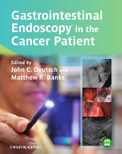 Gastrointestinal Endoscopy in the Cancer Patient