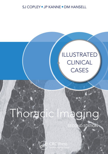 Thoracic Imaging