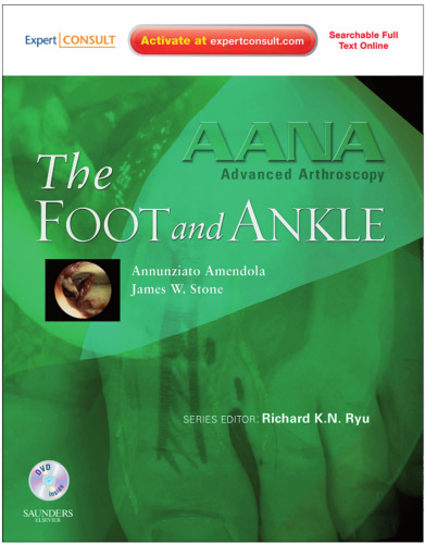 AANA Advanced Arthroscopy. The Foot and Ankle