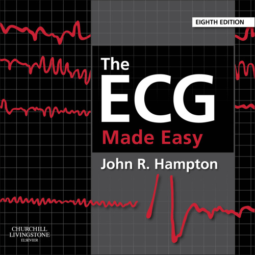 The ECG made easy