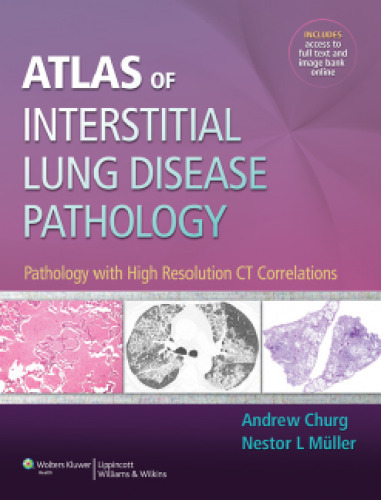 Atlas of Interstitial Lung Disease Pathology: Pathology with High Resolution CT Correlations