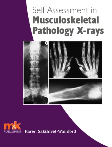 Self-assessment in axial skeleton musculoskeletal trauma X-rays