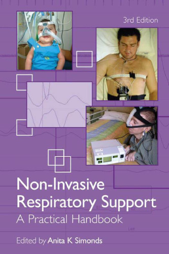 Non-invasive respiratory support : a practical handbook