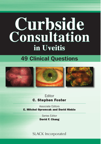 Curbside Consultation in Uveitis: 49 Clinical Questions