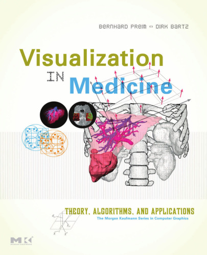 Visualization in medicine. Theory, algorithms, and applications