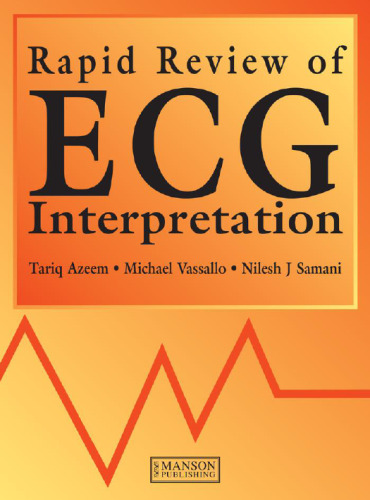 Rapid Review of ECG Interpretation