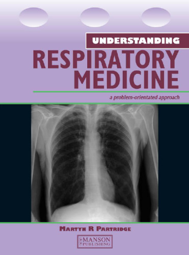 Understanding respiratory medicine : a problem-oriented approach