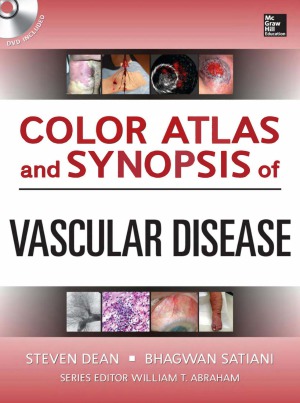 Color Atlas and Synopsis of Vascular Disease