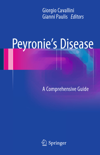 Peyronie’s Disease: A Comprehensive Guide