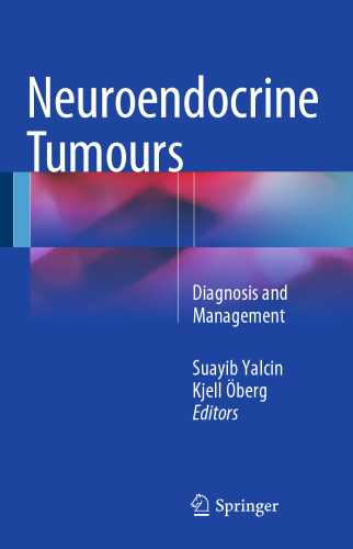 Neuroendocrine Tumours: Diagnosis and Management