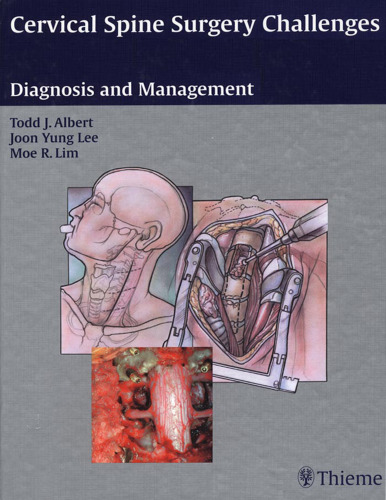 Cervical spine surgery challenges : diagnosis and management