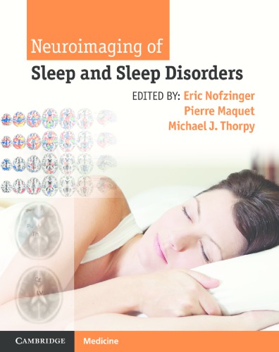 Neuroimaging of Sleep and Sleep Disorders