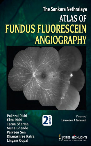 The Sankara Nethralaya Atlas of Fundus Fluorescein Angiography