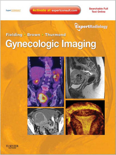 Gynecologic Imaging