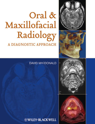 Oral and Maxillofacial Radiology: A Diagnostic Approach