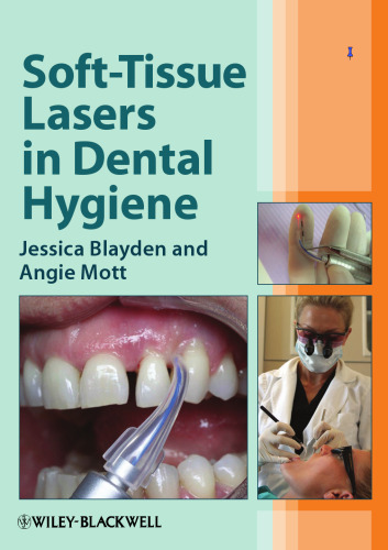 Soft-Tissue Lasers in Dental Hygiene