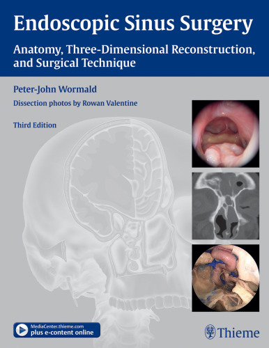 Endoscopic Sinus Surgery: Anatomy, Three-Dimensional Reconstruction, and Surgical Technique