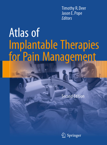 Atlas of Implantable Therapies for Pain Management