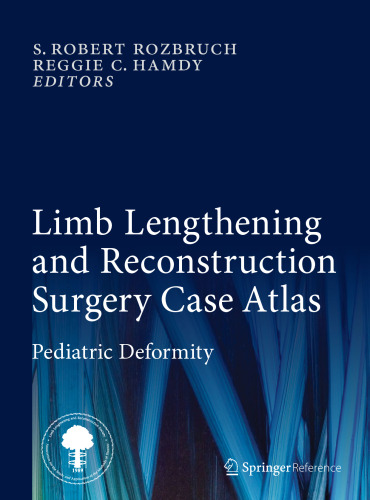 Limb Lengthening and Reconstruction Surgery Case Atlas: Pediatric Deformity