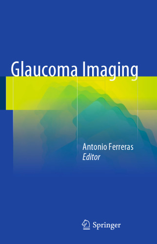 Glaucoma Imaging